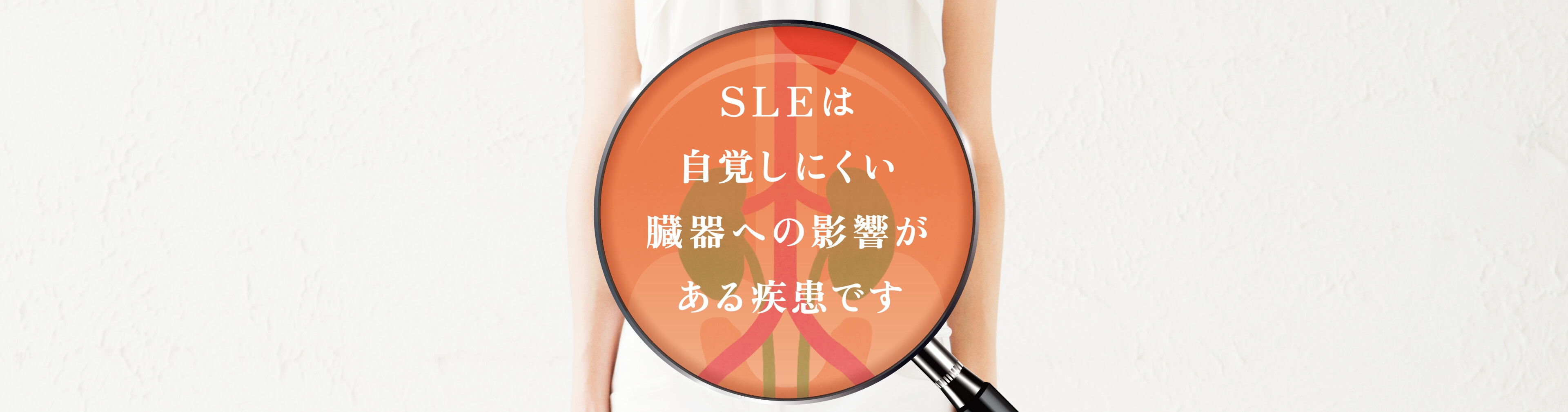 私とSLE
